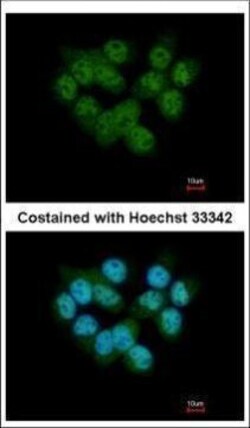 Invitrogen SEPHS2 Polyclonal Antibody 100 &mu;L; Unconjugated:Antibodies,