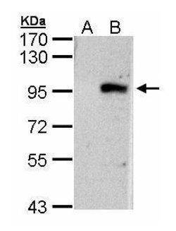 Invitrogen ECEL1 Polyclonal Antibody 100 &mu;L; Unconjugated:Antibodies,