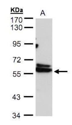 Invitrogen TCP-1 delta Polyclonal Antibody 100 &mu;L; Unconjugated:Antibodies,