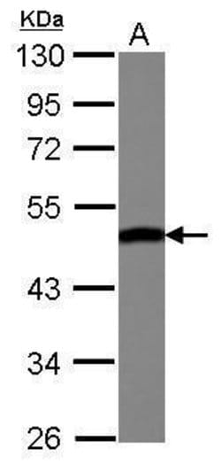 Invitrogen ENO3 Polyclonal Antibody 100 &mu;L; Unconjugated:Antibodies,