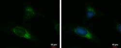 Invitrogen UGGT2 Polyclonal Antibody 100 &mu;L; Unconjugated:Antibodies,