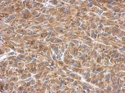 Invitrogen SLK Polyclonal Antibody 100 &mu;L; Unconjugated:Antibodies,