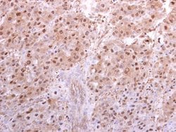 Invitrogen PSMA5 Polyclonal Antibody 100 &mu;L; Unconjugated:Antibodies,
