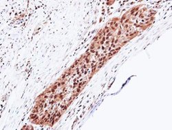 Invitrogen PSMA5 Polyclonal Antibody 100 &mu;L; Unconjugated:Antibodies,