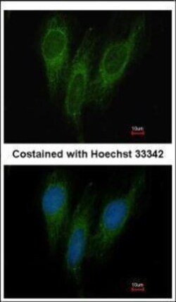 Invitrogen DNAJC1 Polyclonal Antibody 100 &mu;L | Buy Online | Invitrogen&trade; | Fisher Scientific