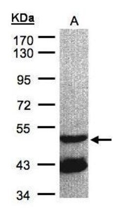 Invitrogen GNAL Polyclonal Antibody 100 &mu;L | Buy Online | Invitrogen&trade; | Fisher Scientific