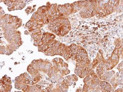 Invitrogen DVL2 Polyclonal Antibody 100 &mu;L; Unconjugated:Antibodies,