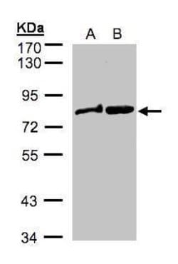 Invitrogen DVL2 Polyclonal Antibody 100 &mu;L; Unconjugated:Antibodies,