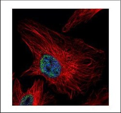 Invitrogen UHRF1 Polyclonal Antibody 100 &mu;L; Unconjugated:Antibodies,