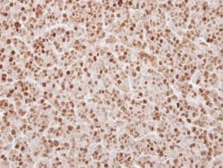 Invitrogen UHRF1 Polyclonal Antibody 100 &mu;L; Unconjugated:Antibodies,
