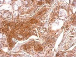 Invitrogen TPK1 Polyclonal Antibody 100 &mu;L; Unconjugated:Antibodies,