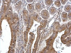 Invitrogen TPK1 Polyclonal Antibody 100 &mu;L; Unconjugated:Antibodies,