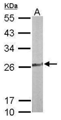 Invitrogen TPK1 Polyclonal Antibody 100 &mu;L; Unconjugated:Antibodies,