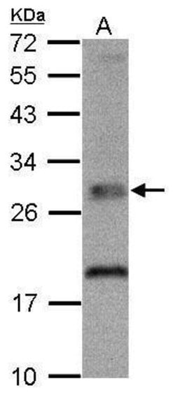 Invitrogen TPK1 Polyclonal Antibody 100 &mu;L; Unconjugated:Antibodies,