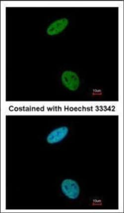 Invitrogen CDK6 Polyclonal Antibody 100 &mu;L | Buy Online | Invitrogen&trade; | Fisher Scientific