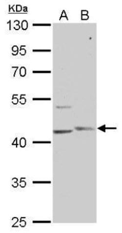 Invitrogen PHKG1 Polyclonal Antibody 100 &mu;L; Unconjugated:Antibodies,