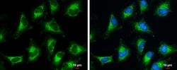 Invitrogen PDHB Polyclonal Antibody 100 &mu;L; Unconjugated:Antibodies,