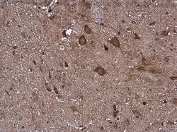 Invitrogen PDHB Polyclonal Antibody 100 &mu;L; Unconjugated:Antibodies,