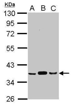 Invitrogen PDHB Polyclonal Antibody 100 &mu;L; Unconjugated:Antibodies,