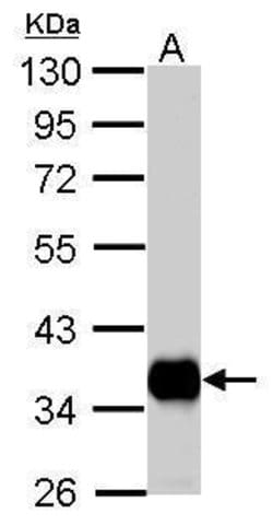 Invitrogen PDHB Polyclonal Antibody 100 &mu;L; Unconjugated:Antibodies,
