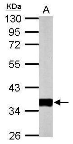 Invitrogen PDHB Polyclonal Antibody 100 &mu;L; Unconjugated:Antibodies,