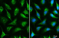Invitrogen IDH3A Polyclonal Antibody 100 &mu;L; Unconjugated:Antibodies,