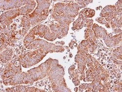 Invitrogen IDH3A Polyclonal Antibody 100 &mu;L; Unconjugated:Antibodies,