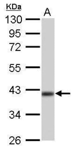 Invitrogen IDH3A Polyclonal Antibody 100 &mu;L; Unconjugated:Antibodies,