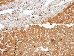Invitrogen FDFT1 Polyclonal Antibody 100 &mu;L; Unconjugated:Antibodies,