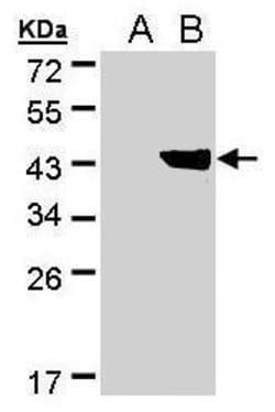 Invitrogen DHDH Polyclonal Antibody 100 &mu;L; Unconjugated:Antibodies,