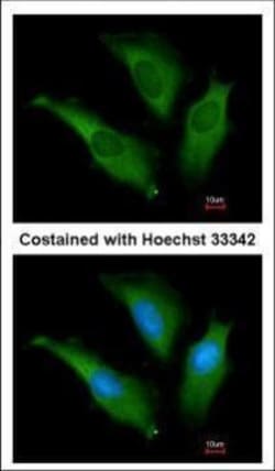 Invitrogen HSP70 Polyclonal Antibody 100 &mu;L; Unconjugated:Anticuerpos