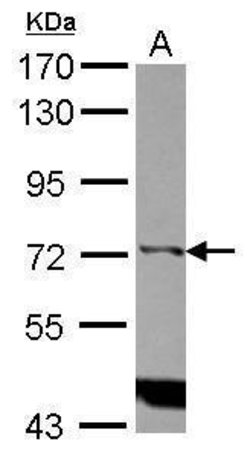 Invitrogen ITPKC Polyclonal Antibody 100 &mu;L | Buy Online | Invitrogen&trade; | Fisher Scientific