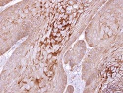 Invitrogen Kallikrein 11 Polyclonal Antibody 100 &mu;L; Unconjugated:Antibodies,