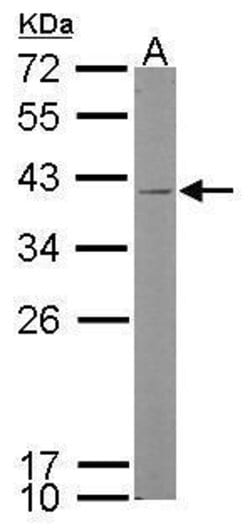 Invitrogen Kallikrein 11 Polyclonal Antibody 100 &mu;L; Unconjugated:Antibodies,