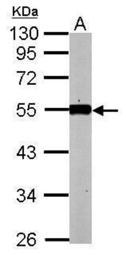 Invitrogen KLF12 Polyclonal Antibody 100 &mu;L; Unconjugated:Antibodies,