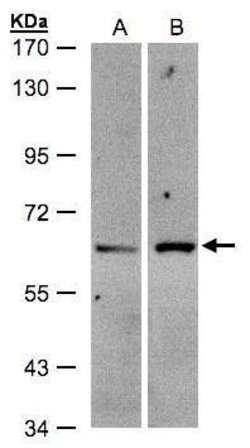 Invitrogen ZSCAN5 Polyclonal Antibody 100 &mu;L; Unconjugated:Antibodies,