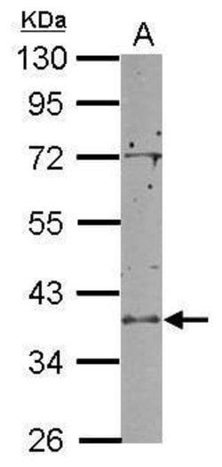 Invitrogen RCL1 Polyclonal Antibody 100 &mu;L; Unconjugated:Antibodies,