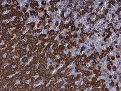Invitrogen FDXR Polyclonal Antibody 100 &mu;L; Unconjugated:Antibodies,