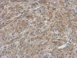 Invitrogen FDXR Polyclonal Antibody 100 &mu;L; Unconjugated:Antibodies,