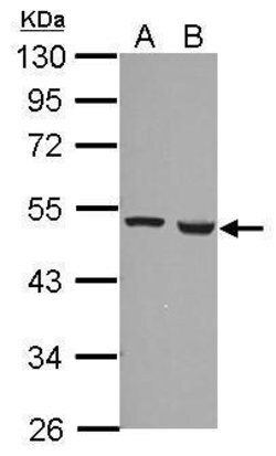 Invitrogen FDXR Polyclonal Antibody 100 &mu;L; Unconjugated:Antibodies,