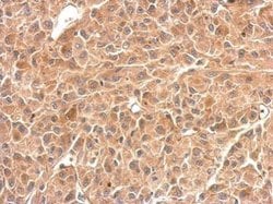 Invitrogen GPBB Polyclonal Antibody 100 &mu;L | Buy Online | Invitrogen&trade; | Fisher Scientific