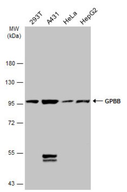 Invitrogen GPBB Polyclonal Antibody 100 &mu;L | Buy Online | Invitrogen&trade; | Fisher Scientific