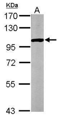 Invitrogen GPBB Polyclonal Antibody 100 &mu;L | Buy Online | Invitrogen&trade; | Fisher Scientific