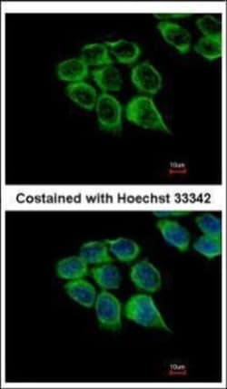 Invitrogen C1r Polyclonal Antibody 100 &mu;L; Unconjugated:Antibodies,