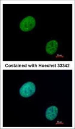 Invitrogen GLI3 Polyclonal Antibody 100 &mu;L; Unconjugated:Antibodies,