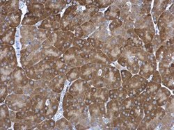 Invitrogen PSMA1 Polyclonal Antibody 100 &mu;L | Buy Online | Invitrogen&trade; | Fisher Scientific
