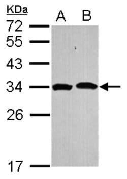 Invitrogen PSMA1 Polyclonal Antibody 100 &mu;L | Buy Online | Invitrogen&trade; | Fisher Scientific