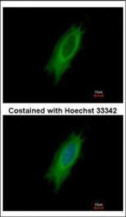 Invitrogen HLA-DPA1 Polyclonal Antibody 100 &mu;L | Buy Online | Invitrogen&trade; | Fisher Scientific