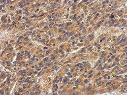 Invitrogen HLA-DPA1 Polyclonal Antibody 100 &mu;L; Unconjugated:Antibodies,