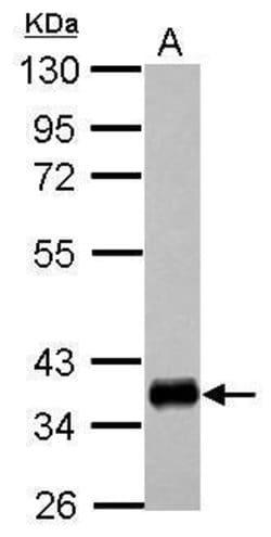 Invitrogen HLA-DPA1 Polyclonal Antibody 100 &mu;L; Unconjugated:Antibodies,